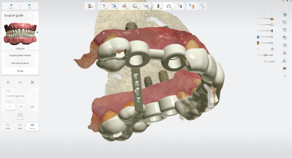 Fúrósablon tervezés 3Shape Implant Studio szoftverben
