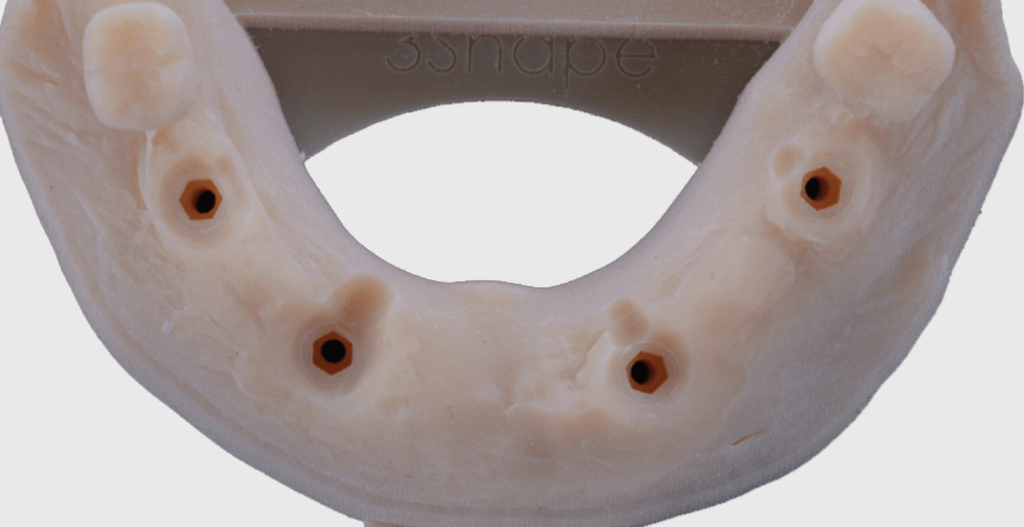 3D nyomtatott modellek