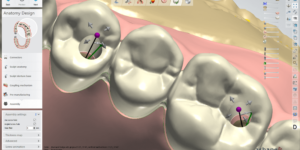 Dental System szoftver