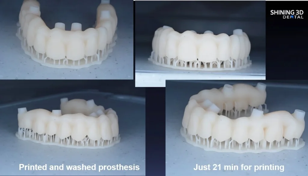 Accufab f1 fogászati 3D nyomtatás